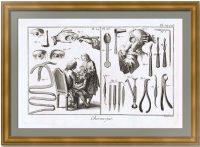 Хирургия Pl. 24 и 25. Операция на глазу. 1779г. Оригинальная гравюра – антикварный подарок медику, глазному врачу, офтальмологу (окулисту)