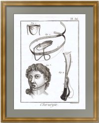 Хирургия Pl. 36. Травмы языка 1779г. Оригинальная гравюра – антикварный подарок медику, врачу-хирургу, стоматологу